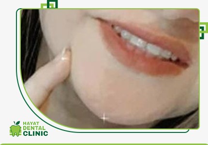 testimonial->img